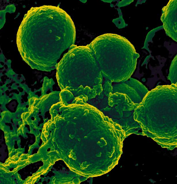 På bilden ser man en vit blodcell som attackerar antibiotikaresistenta bakterier av typen MRSA (Methicillin-resistant_Staphylococccus_aureus).  Bild: Wikimedia